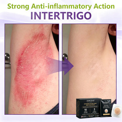 TAG IT. GONE. ZORTRIO LABS Advanced Micro-Point Skin Tag Patch 10 Sterile Patches · 3 Sizes Included